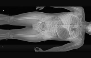 Scuba-accident-fatality-376×483